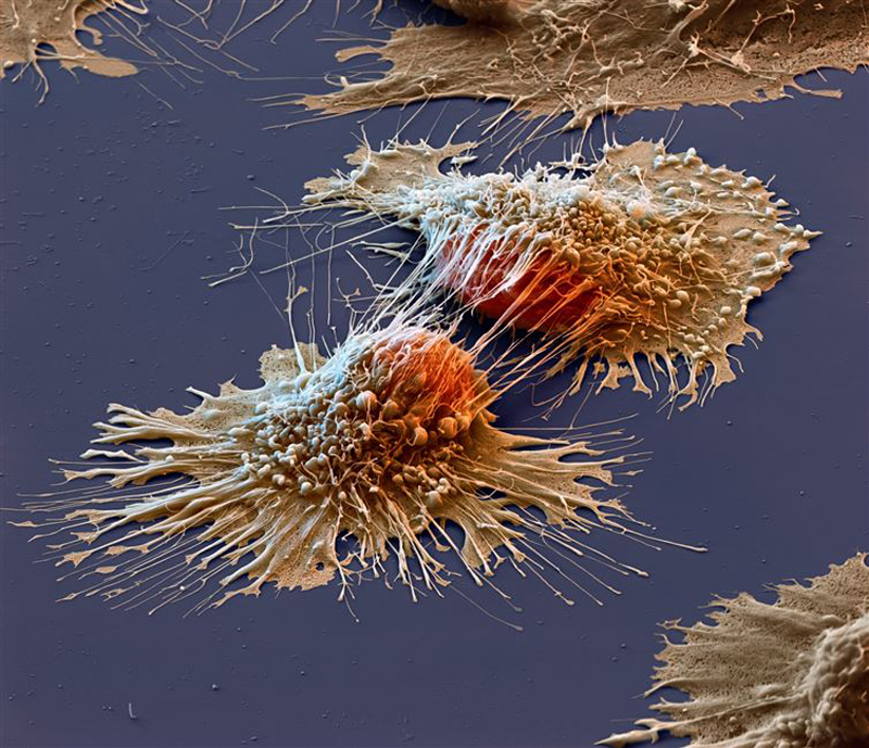 kanser hücreleri büyük hali