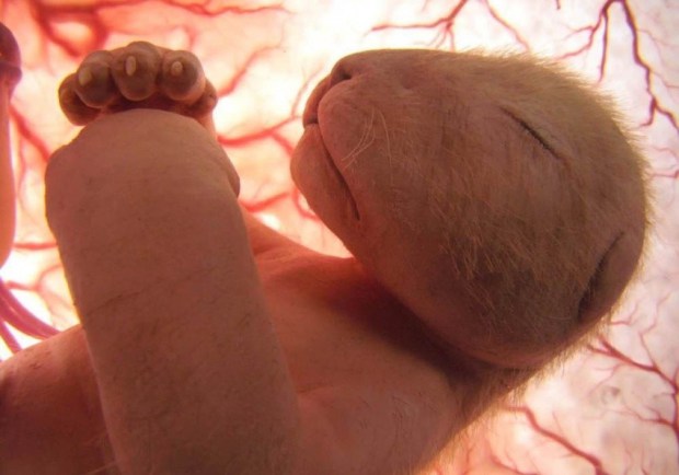 Hayvanların Anne Karnında-rahminde Ultrason Görüntüleri 11