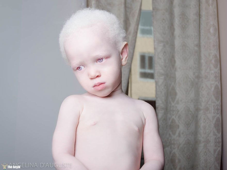 albino-erkek